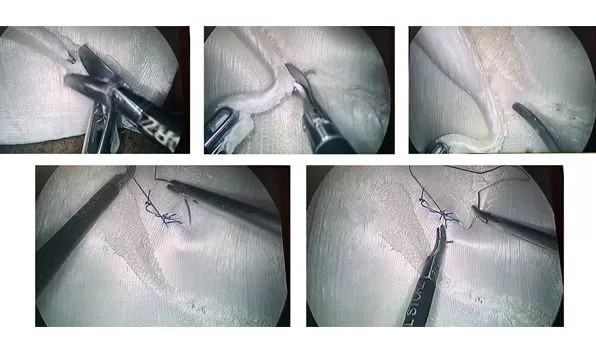 Имитация человеческих органов с помощью 3D‑печати